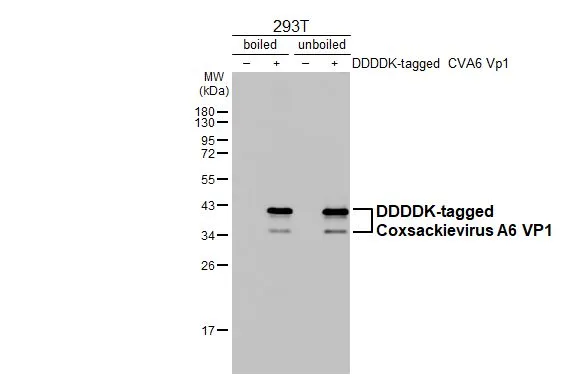 Anti-Coxsackievirus A6 VP1 antibody [HL3698] (GTX641870) | GeneTex