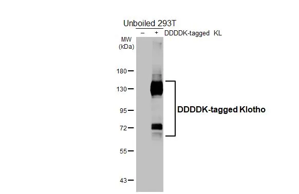 Non-transfected (–) and transfected (+) unboiled 293T whole cell extracts (30 μg) were separated by 7.5% SDS-PAGE, and the membrane was blotted with Klotho antibody [HL3706] (GTX641878) diluted at 1:5000. The HRP-conjugated anti-rabbit IgG antibody (GTX213110-01) was used to detect the primary antibody.