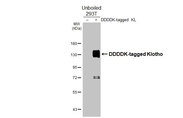 Non-transfected (–) and transfected (+) unboiled 293T whole cell extracts (30 μg) were separated by 7.5% SDS-PAGE, and the membranes were blotted with Klotho antibody [HL3707] (GTX641879) diluted at 1:20000 and competitor's antibody () diluted at 1:. The HRP-conjugated anti-rabbit IgG antibody (GTX213110-01) was used to detect the primary antibody. *The competitor is not affiliated with GeneTex and does not endorse this product.