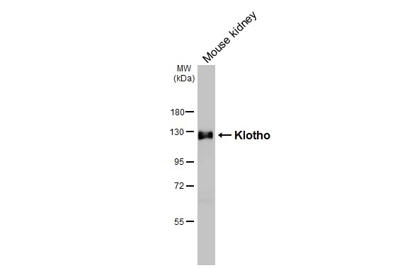 Mouse tissue extract (50 μg) was separated by 7.5% SDS-PAGE, and the membrane was blotted with Klotho antibody [HL3707] (GTX641879) diluted at 1:1000. The HRP-conjugated anti-rabbit IgG antibody (GTX213110-01) was used to detect the primary antibody.