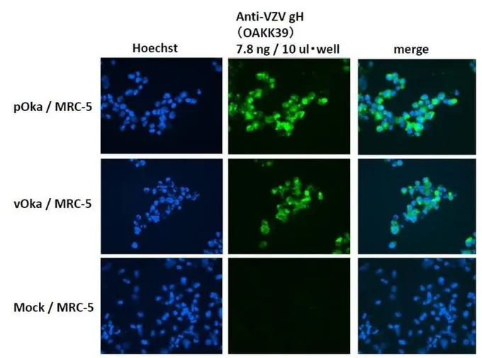 Varicella zoster virus igg. Varicella zoster вирус IGG 1000. MRC-5 клетки.