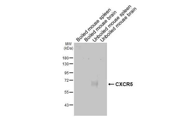 Boiled and unboiled various tissue extracts (50 μg) were separated by 10% SDS-PAGE, and the membrane was blotted with CXCR5 antibody [HL3708] (GTX641880) diluted at 1:1000. The HRP-conjugated anti-rabbit IgG antibody (GTX213110-01) was used to detect the primary antibody, and the signal was developed with Trident ECL plus-Enhanced.