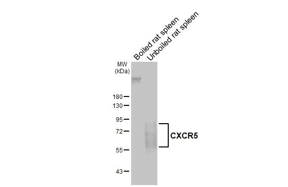 Boiled and unboiled rat tissue extracts (50 μg) were separated by 10% SDS-PAGE, and the membrane was blotted with CXCR5 antibody [HL3708] (GTX641880) diluted at 1:1000. The HRP-conjugated anti-rabbit IgG antibody (GTX213110-01) was used to detect the primary antibody.