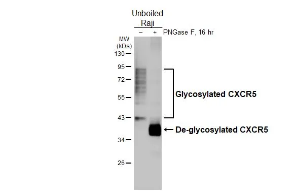 Untreated (–) and treated (+) unboiled Raji whole cell extracts (30 μg) were separated by 10% SDS-PAGE, and the membrane was blotted with CXCR5 antibody [HL3708] (GTX641880) diluted at 1:1000. The HRP-conjugated anti-rabbit IgG antibody (GTX213110-01) was used to detect the primary antibody, and the signal was developed with Trident ECL plus-Enhanced.