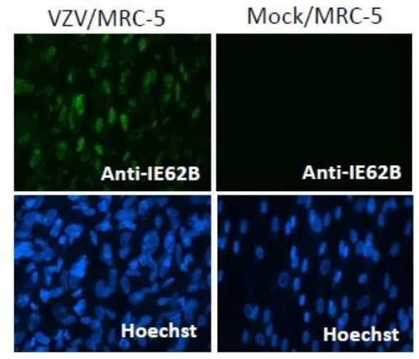Immunofluorescence staining of VZV IE62 protein in VZV-infected MRC-5 cells by using anti-VZV IE62 antibody (clone 62B). Anti-VZV IE62 antibody was used at 1/100 dilution. As second antibody, Alexa Fluor 488 donkey anti-mouse IgG [H+L] was used at 1/200 dilution. Nuclei were stained with Hoechst 33342.