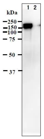 Identification of IE62 protein in VZV-infected cells by western blotting using anti-VZV IE62 antibody (clone 62B). Lane 1; VZV strain pOka infected MRC-5 cell lysate Lane 2; MRC-5 cell lysate ( uninfected negative control ) The anti-VZV IE62 antibody was used at 1/5,000 dilution