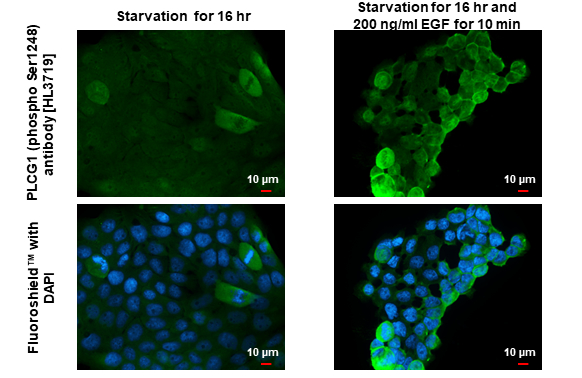 PLCG1 (phospho Ser1248) antibody [HL3719] detects PLCG1 (phospho Ser1248) protein by immunofluorescent analysis. Sample: Mock and treated A431 cells were fixed in 4% paraformaldehyde at RT for 15 min. Green: PLCG1 (phospho Ser1248) stained by PLCG1 (phospho Ser1248) antibody [HL3719] (GTX641909) diluted at 1:500. Blue: Fluoroshield with DAPI (GTX30920).