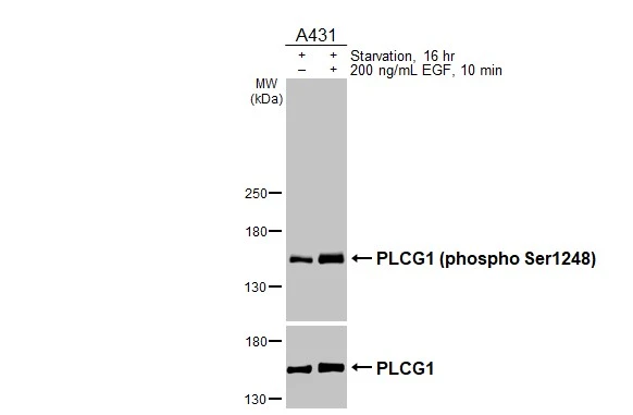 Untreated (–) and treated (+) A431 whole cell extracts (30 μg) were separated by 5% SDS-PAGE, and the membranes were blotted with PLCG1 (phospho Ser1248) antibody [HL3719] (GTX641909) diluted at 1:1000 and PLCG1 antibody (GTX641396) diluted at 1:1000. The HRP-conjugated anti-rabbit IgG antibody (GTX213110-01) was used to detect the primary antibody.