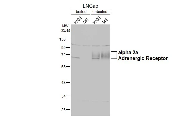 Boiled and unboiled LNCap whole cell and membrane extracts (30 μg) were separated by 10% SDS-PAGE, and the membrane was blotted with alpha 2a Adrenergic Receptor antibody [HL3723] (GTX641913) diluted at 1:1000. The HRP-conjugated anti-rabbit IgG antibody (GTX213110-01) was used to detect the primary antibody. (WCE: whole cell extract; ME: membrane extract)