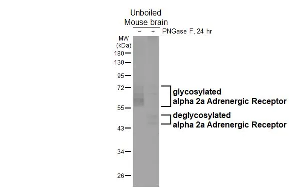 Untreated (–) and treated (+) unboiled mouse tissue extracts (50 μg) were separated by 10% SDS-PAGE, and the membrane was blotted with alpha 2a Adrenergic Receptor antibody [HL3723] (GTX641913) diluted at 1:1000. The HRP-conjugated anti-rabbit IgG antibody (GTX213110-01) was used to detect the primary antibody, and the signal was developed with Trident ECL plus-Enhanced.