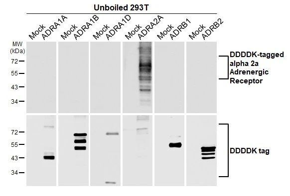 Unboiled non-transfected (–) and transfected (+) 293T whole cell extracts (30 μg) were separated by 10% SDS-PAGE, and the membrane was blotted with alpha 2a Adrenergic Receptor antibody [HL3723] (GTX641913) diluted at 1:5000. The HRP-conjugated anti-rabbit IgG antibody (GTX213110-01) was used to detect the primary antibody.