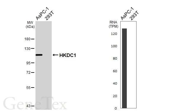 Various whole cell extracts (30 μg) were separated by 7.5% SDS-PAGE, and the membrane was blotted with HKDC1 antibody [HL3743] (GTX641933) diluted at 1:1000. The HRP-conjugated anti-rabbit IgG antibody (GTX213110-01) was used to detect the primary antibody. Corresponding RNA expression data for the same cell lines are based on Human Protein Atlas program.