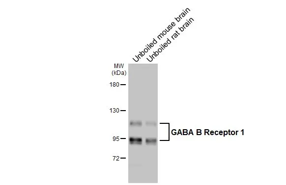 Unboiled various tissue extracts (50 μg) were separated by 5% SDS-PAGE, and the membrane was blotted with GABA B Receptor 1 antibody [GT83] (GTX641938) diluted at 1:1000. The HRP-conjugated anti-mouse IgG antibody (GTX213111-01) was used to detect the primary antibody, and the signal was developed with Trident ECL plus-Enhanced.