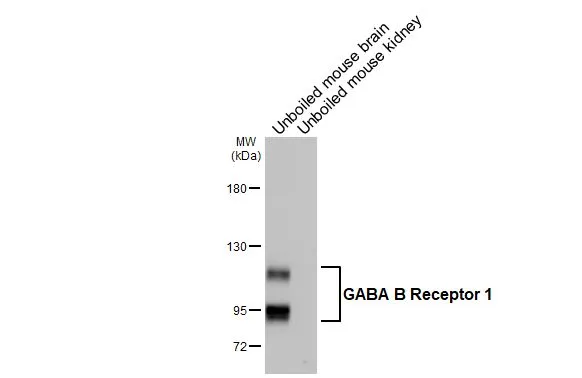 Unboiled various tissue extracts (50 μg) were separated by 5% SDS-PAGE, and the membrane was blotted with GABA B Receptor 1 antibody [GT83] (GTX641938) diluted at 1:1000. The HRP-conjugated anti-mouse IgG antibody (GTX213111-01) was used to detect the primary antibody.