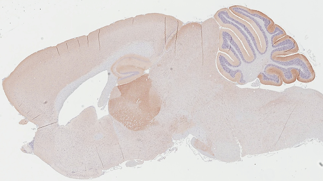 GABA B Receptor 1 antibody [GT83] detects GABA B Receptor 1 protein by immunohistochemical analysis. Sample: Paraffin-embedded mouse brain. GABA B Receptor 1 stained by GABA B Receptor 1 antibody [GT83] (GTX641938) diluted at 1:100. Antigen Retrieval: Tris-EDTA buffer, pH 9.0, 15 min