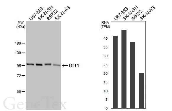 Various whole cell extracts (30 μg) were separated by 7.5% SDS-PAGE, and the membrane was blotted with GIT1 antibody [GT87] (GTX641942) diluted at 1:1000. The HRP-conjugated anti-mouse IgG antibody (GTX213111-01) was used to detect the primary antibody. Corresponding RNA expression data for the same cell lines are based on Human Protein Atlas program.