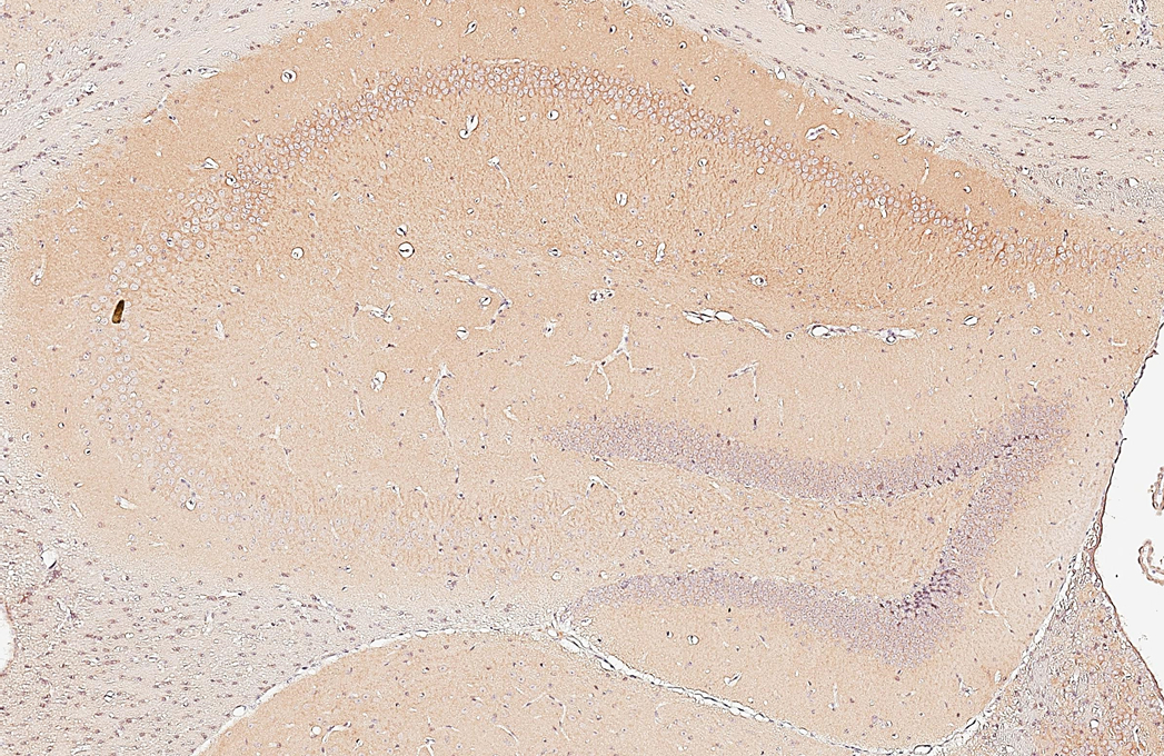 GIT1 antibody [GT87] detects GIT1 protein by immunohistochemical analysis. Sample: Paraffin-embedded mouse hippocampus. GIT1 stained by GIT1 antibody [GT87] (GTX641942) diluted at 1:100. Antigen Retrieval: Citrate buffer, pH 6.0, 15 min