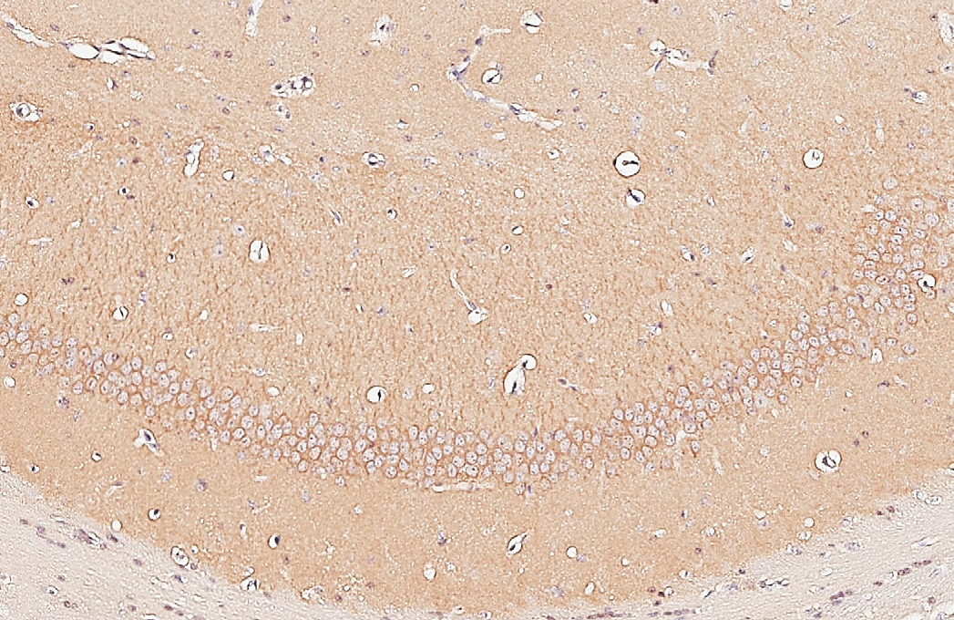 GIT1 antibody [GT87] detects GIT1 protein by immunohistochemical analysis. Sample: Paraffin-embedded mouse hippocampus. GIT1 stained by GIT1 antibody [GT87] (GTX641942) diluted at 1:100. Antigen Retrieval: Citrate buffer, pH 6.0, 15 min