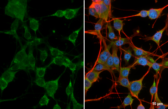 GIT1 antibody [GT87] detects GIT1 protein by immunofluorescent analysis. Sample: U87-MG cells were fixed in 4% paraformaldehyde at RT for 15 min. Green: GIT1 stained by GIT1 antibody [GT87] (GTX641942) diluted at 1:500. Red: alpha Tubulin, a cytoskeleton marker, stained by alpha Tubulin antibody [HL2162] (GTX638140) diluted at 1:500. Blue: Fluoroshield with DAPI (GTX30920).