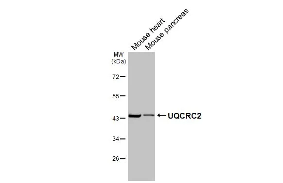 Various tissue extracts (50 μg) were separated by 10% SDS-PAGE, and the membrane was blotted with UQCRC2 antibody [HL3749] (GTX641948) diluted at 1:1000. The HRP-conjugated anti-rabbit IgG antibody (GTX213110-01) was used to detect the primary antibody.
