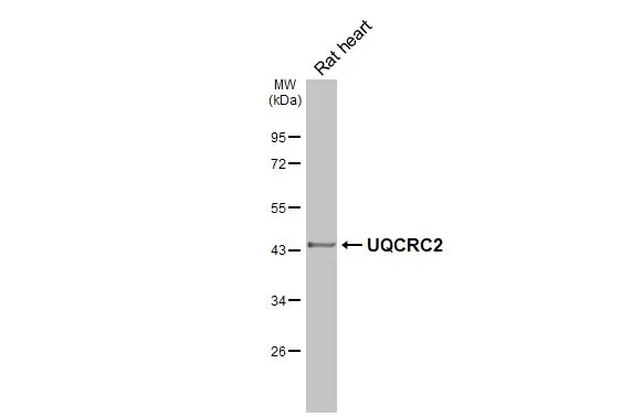 Rat tissue extract (50 μg) was separated by 10% SDS-PAGE, and the membrane was blotted with UQCRC2 antibody [HL3749] (GTX641948) diluted at 1:1000. The HRP-conjugated anti-rabbit IgG antibody (GTX213110-01) was used to detect the primary antibody.