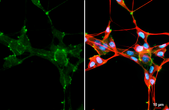 LRRC15 antibody [HL3750] detects LRRC15 protein by immunofluorescent analysis. Sample: U87-MG cells were fixed in ice-cold MeOH for 5 min. Green: LRRC15 stained by LRRC15 antibody [HL3750] (GTX641949) diluted at 1:500. Red: alpha Tubulin, a cytoskeleton marker, stained by alpha Tubulin antibody [GT114] (GTX628802) diluted at 1:1000. Blue: Fluoroshield with DAPI (GTX30920).
