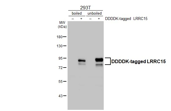 Non-transfected (–) and transfected (+) boiled and unboiled 293T whole cell extracts (30 μg) were separated by 7.5% SDS-PAGE, and the membrane was blotted with LRRC15 antibody [HL3750] (GTX641949) diluted at 1:5000. The HRP-conjugated anti-rabbit IgG antibody (GTX213110-01) was used to detect the primary antibody.