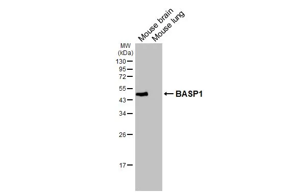 Various tissue extracts (50 μg) were separated by 12% SDS-PAGE, and the membrane was blotted with BASP1 antibody [HL3760] (GTX641959) diluted at 1:1000. The HRP-conjugated anti-rabbit IgG antibody (GTX213110-01) was used to detect the primary antibody.