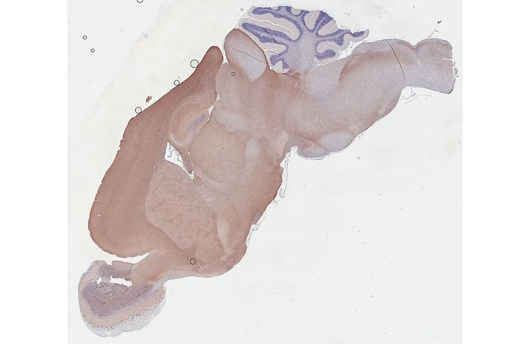 BASP1 antibody [HL3760] detects BASP1 protein by immunohistochemical analysis. Sample: Paraffin-embedded mouse brain. BASP1 stained by BASP1 antibody [HL3760] (GTX641959) diluted at 1:250. Antigen Retrieval: Citrate buffer, pH 6.0, 15 min