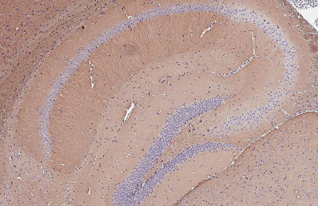 BASP1 antibody [HL3760] detects BASP1 protein by immunohistochemical analysis. Sample: Paraffin-embedded mouse hippocampus. BASP1 stained by BASP1 antibody [HL3760] (GTX641959) diluted at 1:250. Antigen Retrieval: Citrate buffer, pH 6.0, 15 min