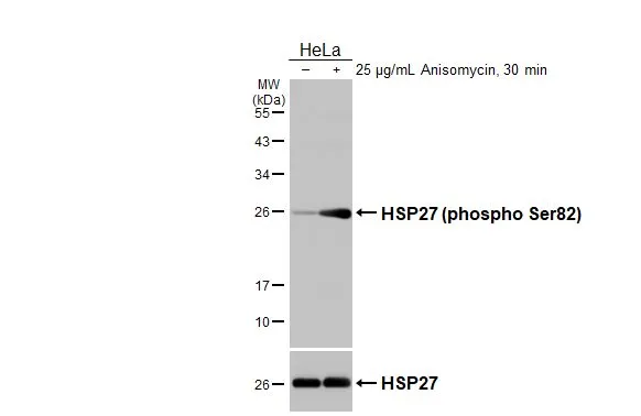 Untreated (–) and treated (+) HeLa whole cell extracts (30 μg) were separated by 12% SDS-PAGE, and the membranes were blotted with HSP27 (phospho Ser82) antibody [HL3761] (GTX641960) diluted at 1:1000 and HSP27 antibody (GTX101145) diluted at 1:1000. The HRP-conjugated anti-rabbit IgG antibody (GTX213110-01) was used to detect the primary antibody.