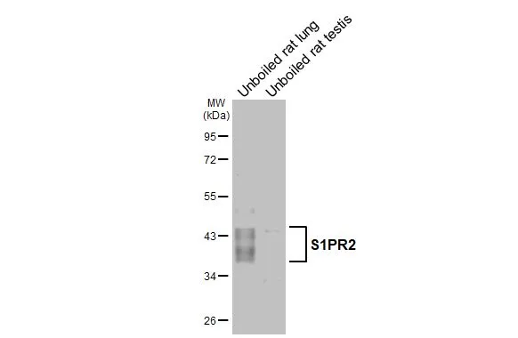Unboiled various tissue extracts (50 μg) were separated by 10% SDS-PAGE, and the membrane was blotted with S1PR2 antibody [HL3765] (GTX641964) diluted at 1:1000. The HRP-conjugated anti-rabbit IgG antibody (GTX213110-01) was used to detect the primary antibody, and the signal was developed with Trident ECL plus-Enhanced.