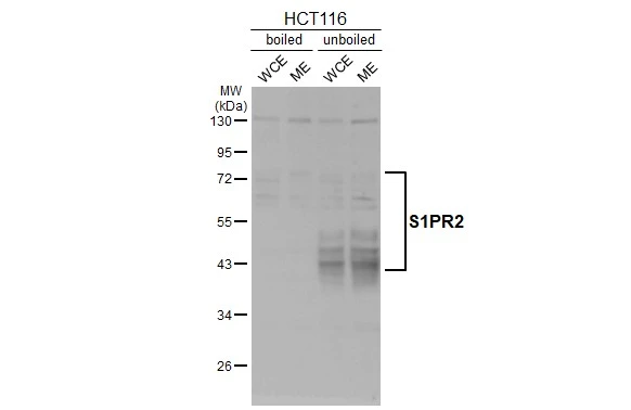 Boiled and unboiled HCT116 whole cell and membrane extracts (30 μg) were separated by 10% SDS-PAGE, and the membrane was blotted with S1PR2 antibody [HL3765] (GTX641964) diluted at 1:1000. The HRP-conjugated anti-rabbit IgG antibody (GTX213110-01) was used to detect the primary antibody.(WCE: whole cell extract; ME: membrane extract)