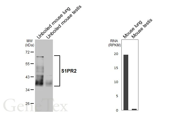 Unboiled various tissue extracts (50 μg) were separated by 10% SDS-PAGE, and the membrane was blotted with S1PR2 antibody [HL3765] (GTX641964) diluted at 1:1000. The HRP-conjugated anti-rabbit IgG antibody (GTX213110-01) was used to detect the primary antibody. Corresponding RNA expression data are based on NCBI database.