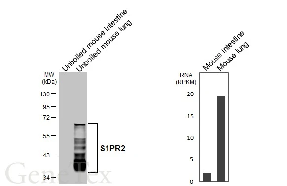 Unboiled various tissue extracts (30 μg) were separated by 10% SDS-PAGE, and the membrane was blotted with S1PR2 antibody [HL3765] (GTX641964) diluted at 1:2400. The HRP-conjugated anti-rabbit IgG antibody (GTX213110-01) was used to detect the primary antibody. Corresponding RNA expression data are based on NCBI database.