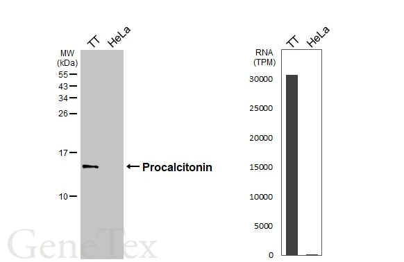 Various whole cell extracts (30 μg) were separated by 15% SDS-PAGE, and the membranes were blotted with Procalcitonin antibody [HL3769] (GTX641968) diluted at 1:1000 and competitor's antibody () diluted at 1:. The HRP-conjugated anti-rabbit IgG antibody (GTX213110-01) was used to detect the primary antibody. Corresponding RNA expression data for the same cell lines are based on Human Protein Atlas program. *The competitor is not affiliated with GeneTex and does not endorse this product.