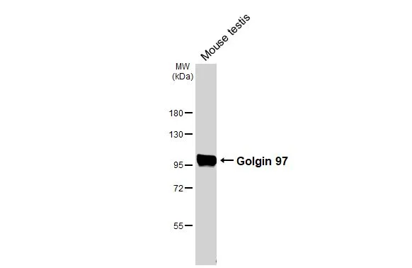 Mouse tissue extract (50 μg) was separated by 7.5% SDS-PAGE, and the membrane was blotted with Golgin 97 antibody [HL3788] (GTX642007) diluted at 1:1000. The HRP-conjugated anti-rabbit IgG antibody (GTX213110-01) was used to detect the primary antibody.