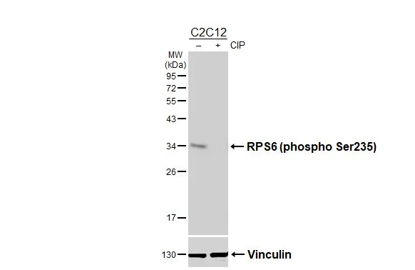 Untreated (–) and treated (+) C2C12 whole cell extracts (30 μg) were separated by 12% SDS-PAGE, and the membrane was blotted with RPS6 (phospho Ser235) antibody [HL3793] (GTX642012) diluted at 1:1000. The HRP-conjugated anti-rabbit IgG antibody (GTX213110-01) was used to detect the primary antibody.