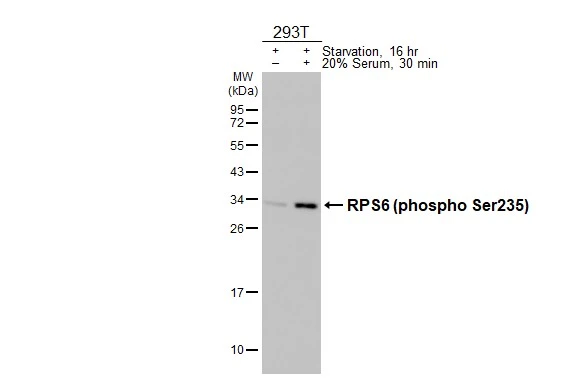 Untreated (–) and treated (+) 293T whole cell extracts (30 μg) were separated by 12% SDS-PAGE, and the membrane was blotted with RPS6 (phospho Ser235) antibody [HL3793] (GTX642012) diluted at 1:1000. The HRP-conjugated anti-rabbit IgG antibody (GTX213110-01) was used to detect the primary antibody.