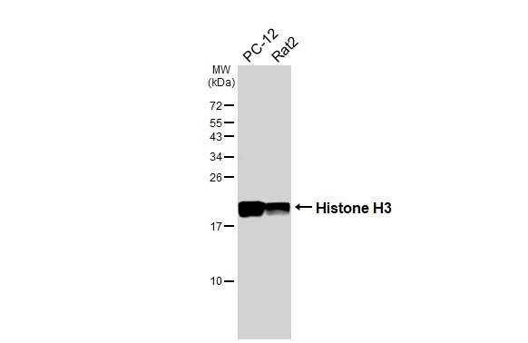 Various whole cell extracts (30 μg) were separated by 15% SDS-PAGE, and the membrane was blotted with Histone H3 antibody [HL3803] (GTX642022) diluted at 1:1000. The HRP-conjugated anti-rabbit IgG antibody (GTX213110-01) was used to detect the primary antibody.