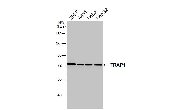 Various whole cell extracts (30 μg) were separated by 7.5% SDS-PAGE, and the membrane was blotted with TRAP1 antibody [HL3809] (GTX642033) diluted at 1:1000. The HRP-conjugated anti-rabbit IgG antibody (GTX213110-01) was used to detect the primary antibody.