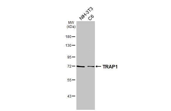 Various whole cell extracts (30 μg) were separated by 7.5% SDS-PAGE, and the membrane was blotted with TRAP1 antibody [HL3809] (GTX642033) diluted at 1:1000. The HRP-conjugated anti-rabbit IgG antibody (GTX213110-01) was used to detect the primary antibody.
