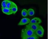 ICC/IF analysis of MCF-7 cells using GTX64270 IGF2 Receptor antibody [GT1078]. Fixation : 4% PFA Permeabilization : 0.25% Triton X-100 in PBS Green : Primary antibody Blue : DAPI