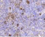 IHC-P analysis of human tonsil tissue using GTX64270 IGF2 Receptor antibody [GT1078].