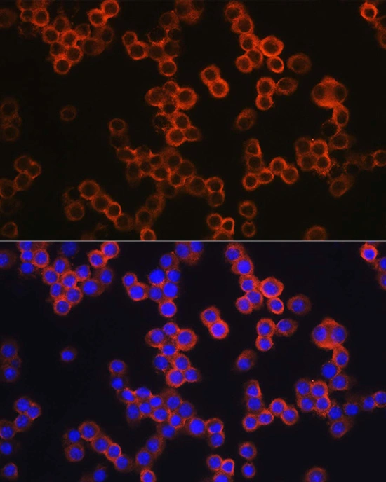ICC/IF analysis of RAW264.7 cells using GTX64330 TLR4 antibody. Orange : Primary antibody Blue : DAPI Dilution : 1:200 ICC/IF analysis of RAW264.7 cells using GTX64330 TLR4 antibody. Orange : Primary antibody Blue : DAPI Dilution : 1:200