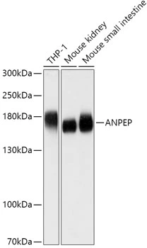 WB analysis of various sample lysates using GTX64331 CD13 antibody. Dilution : 1:1000 Loading : 25microg per lane WB analysis of various sample lysates using GTX64331 CD13 antibody. Dilution : 1:1000 Loading : 25microg per lane