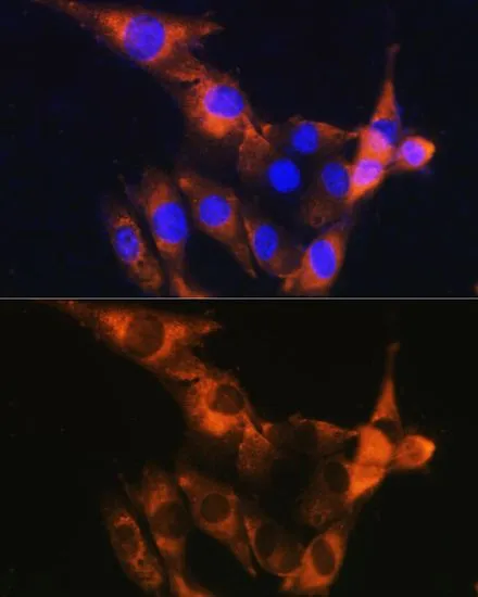 ICC/IF analysis of NIH/3T3 cells using GTX64331 CD13 antibody. Blue : DAPI Dilution : 1:100