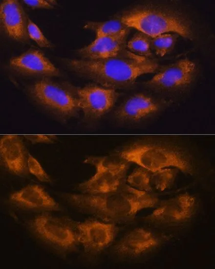 ICC/IF analysis of C6 cells using GTX64331 CD13 antibody. Blue : DAPI Dilution : 1:100