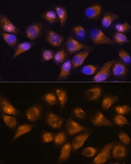 ICC/IF analysis of HeLa cells using GTX64331 CD13 antibody. Blue : DAPI Dilution : 1:100