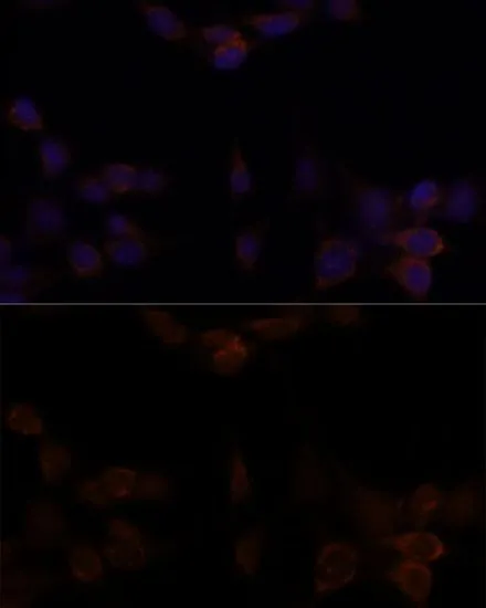 ICC/IF analysis of NIH/3T3 cells using GTX64336 YAP1 antibody. Blue : DAPI Dilution : 1:100